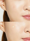 COSRX: Acne Pimple Master Patch (24pcs)