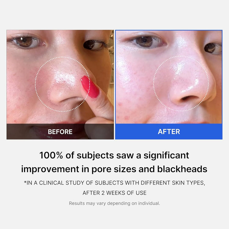 medicube: Zero Pore Pad 2.0