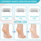 Portable Pedicure Machine for Foot Care