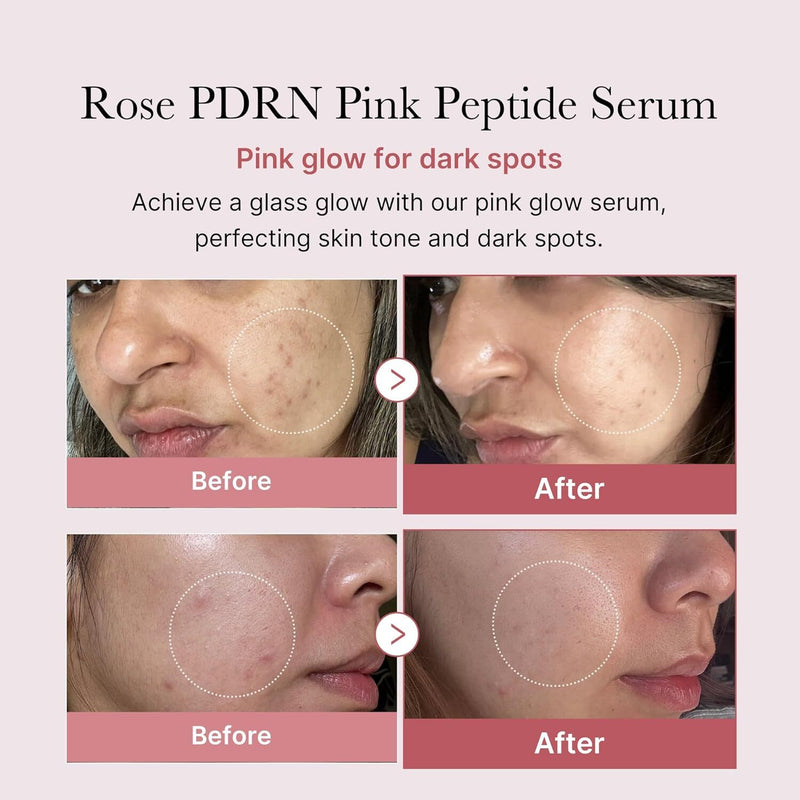 medicube: PDRN Pink Peptide Serum